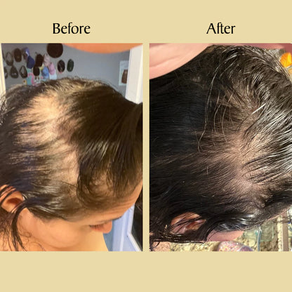 Levello™ Veganic Natural Hair Growth Oil