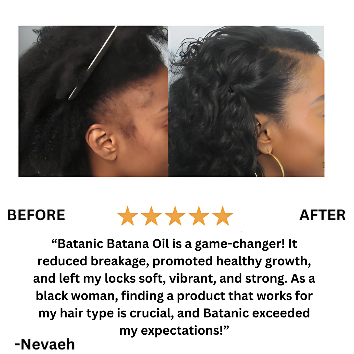 Batanic™️ Batana Natural Hair Growth Oil